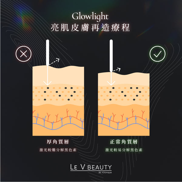 Glowlight 亮肌再生療程 (十次療程）